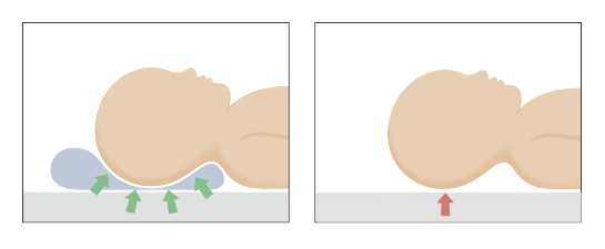 pressure relief